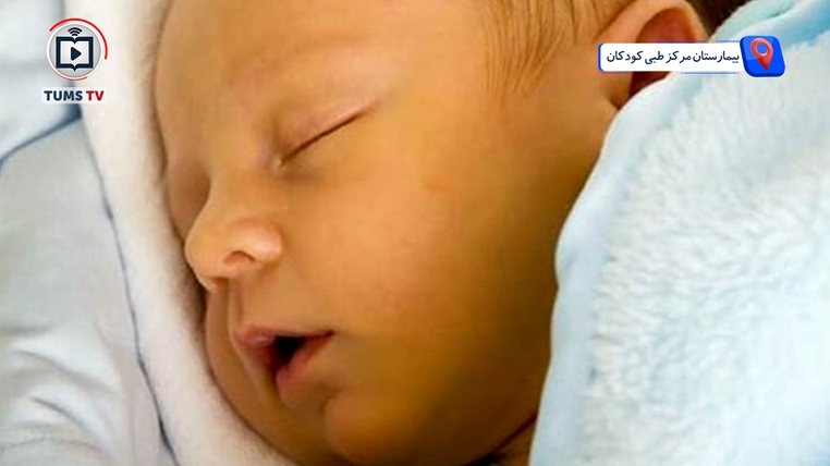 تداوم زردی بیش از دو هفته، زنگ خطر برای کبد نوزاد